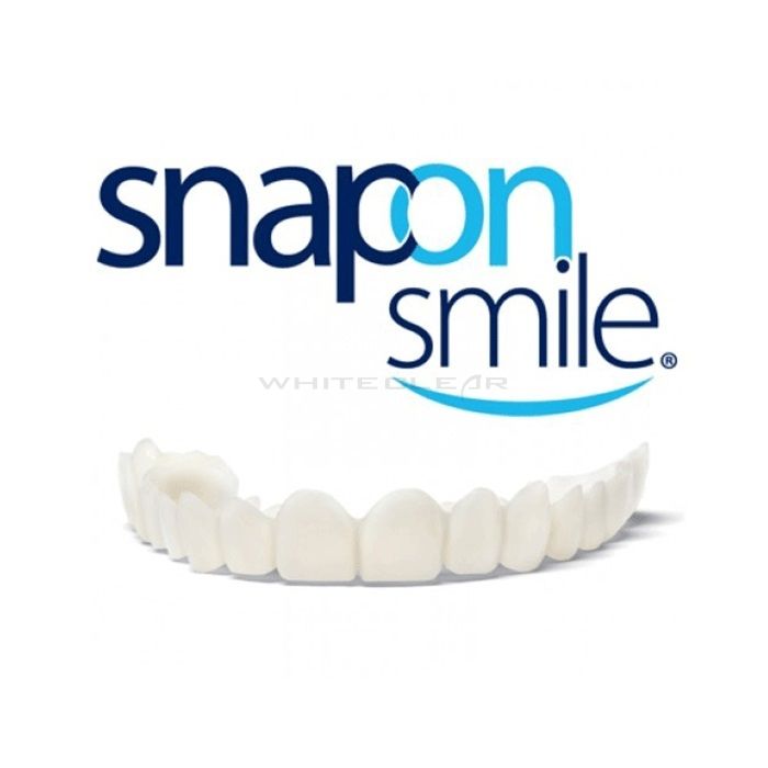 ❰★❱ Snap-On Smile - виниры